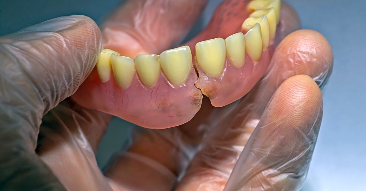 Can an emergency dentist treat a broken dental bridge or denture?