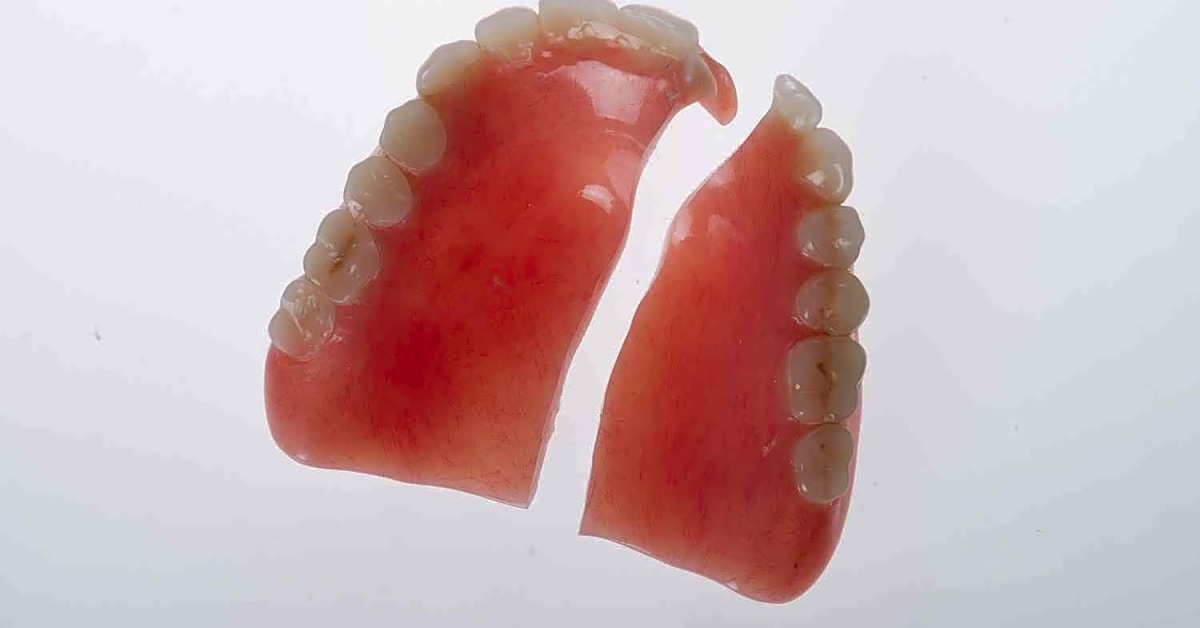 What should i do if my dentures break in an accident?